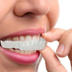 Faccette Dentali (Includono Superiore e Inferiore)