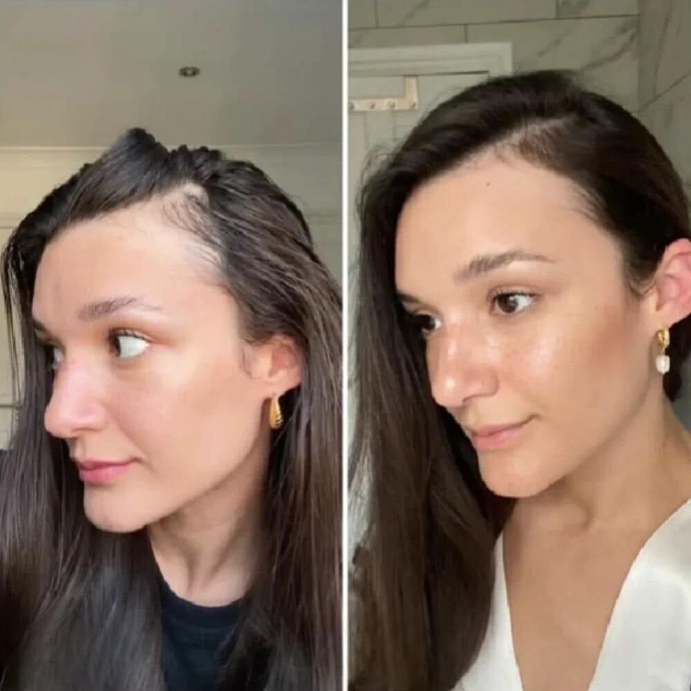 Il tuo olio naturale per la crescita dei capelli