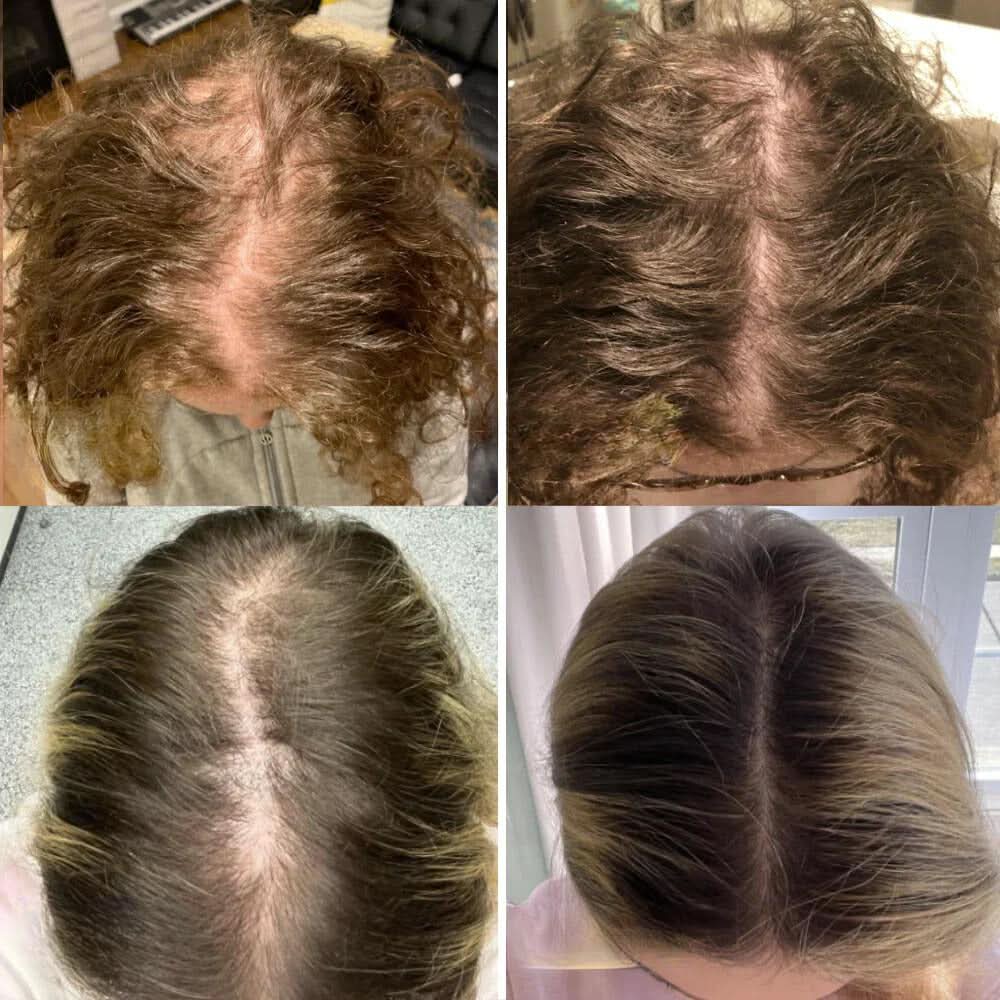 Il tuo olio naturale per la crescita dei capelli