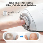 NailGlide – Montalunette Elettrico per Tutte le Età