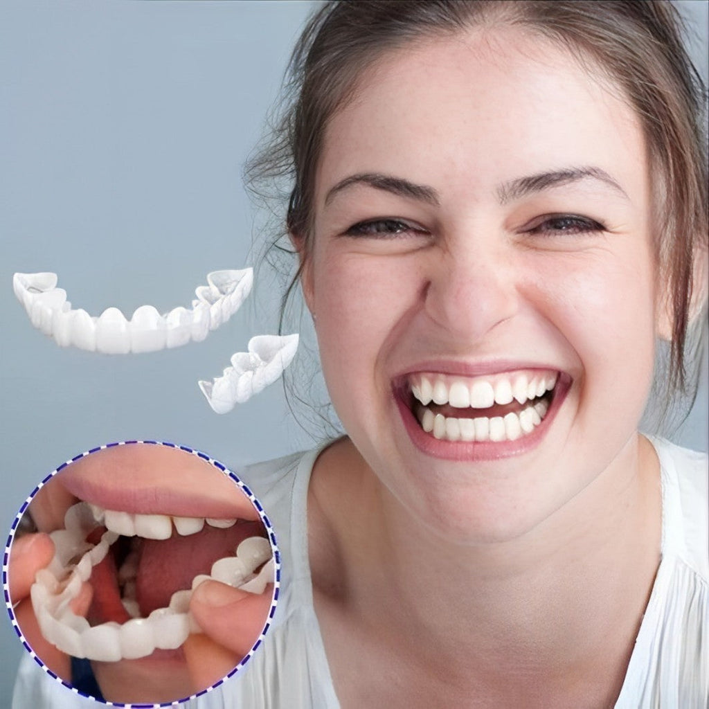 Faccette Dentali (Includono Superiore e Inferiore)