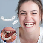 Faccette Dentali (Includono Superiore e Inferiore)