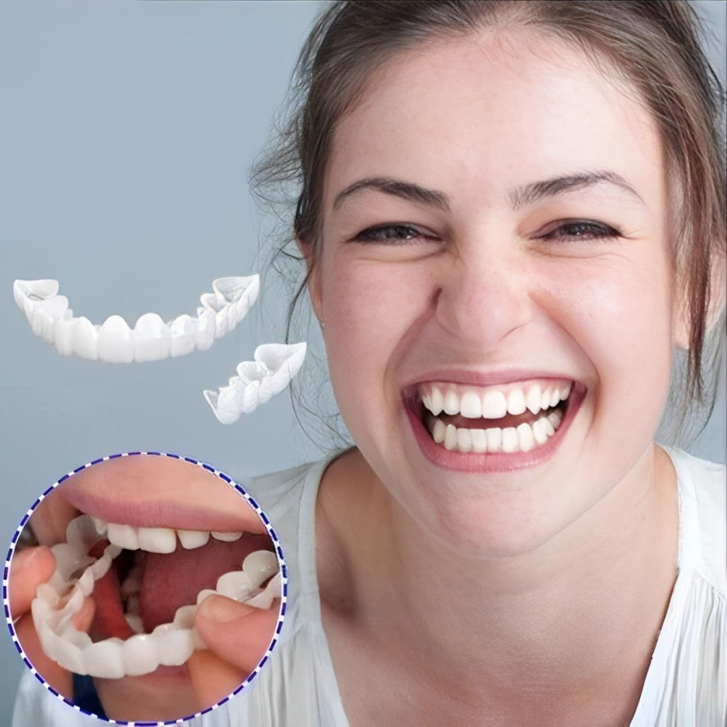Faccette Dentali (Includono Superiore e Inferiore)