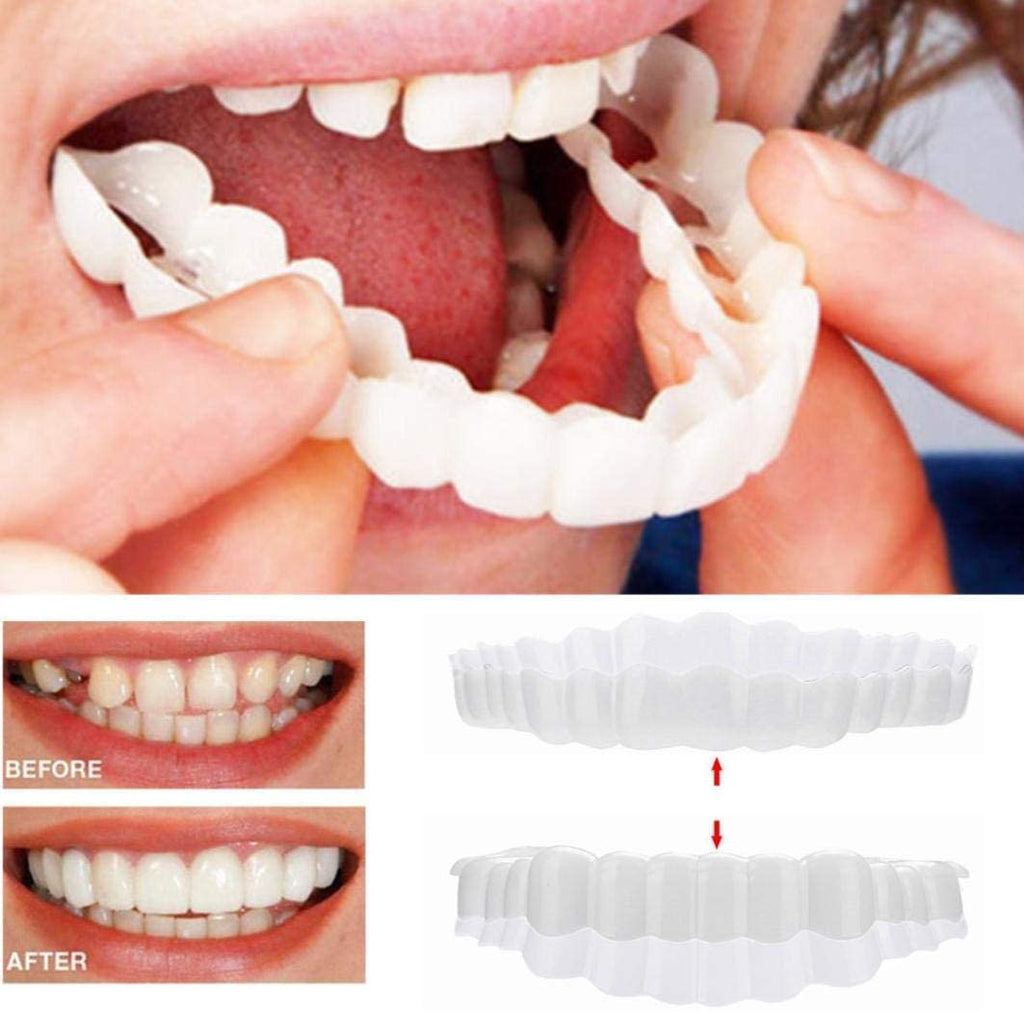 Faccette Dentali (Includono Superiore e Inferiore)