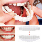 Faccette Dentali (Includono Superiore e Inferiore)