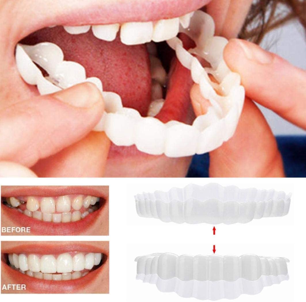 Faccette Dentali (Includono Superiore e Inferiore)