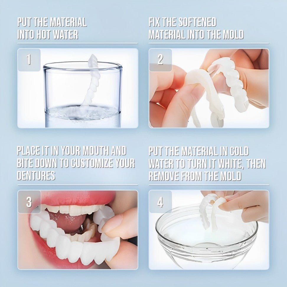 Faccette Dentali (Includono Superiore e Inferiore)