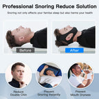 Fascia Mentale Antisnoring per Apnea Notturna