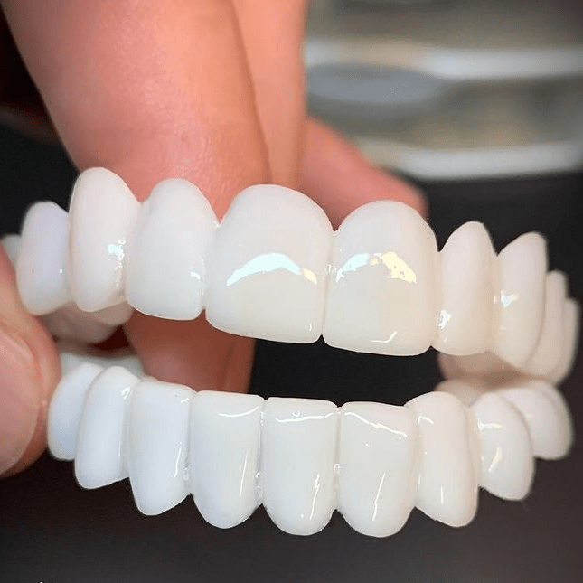 ORALUXE - Protesi dentali estetiche riutilizzabili con lenti dentali bianche per un sorriso luminoso, dall'aspetto naturale e sicuro