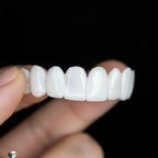 ORALUXE - Protesi dentali estetiche riutilizzabili con lenti dentali bianche per un sorriso luminoso, dall'aspetto naturale e sicuro