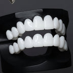 ORALUXE - Protesi dentali estetiche riutilizzabili con lenti dentali bianche per un sorriso luminoso, dall'aspetto naturale e sicuro