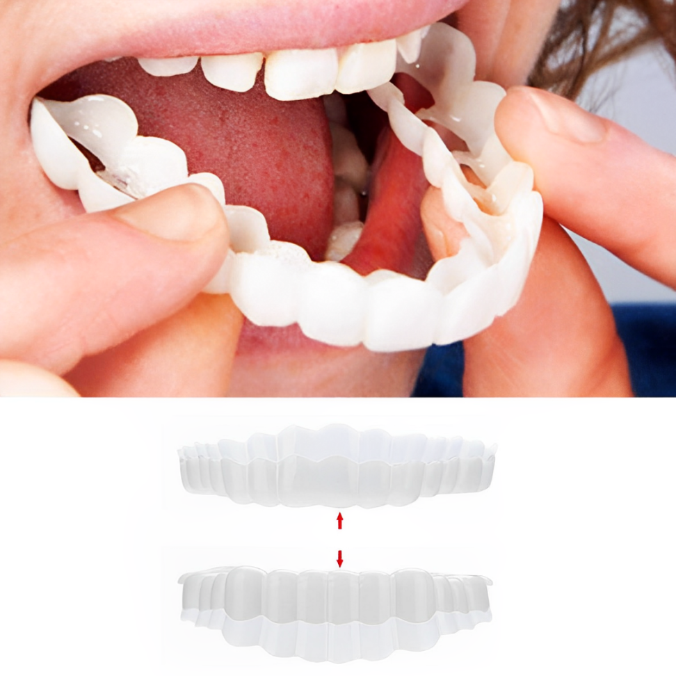 Faccette Dentali (Includono Superiore e Inferiore)