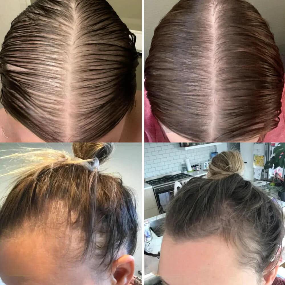 Il tuo olio naturale per la crescita dei capelli